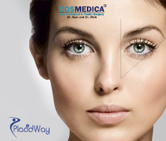 Slider image (9) Cosmedica Hair Transplant and Plastic Surgery